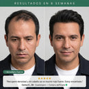 Champú de Crecimiento Dexvon™ - Romero + Queratina