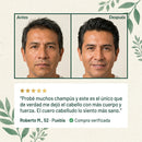 Champú de Crecimiento Dexvon™ - Romero + Queratina